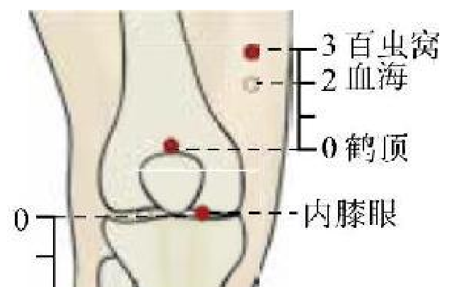 常見病癥及穴位插圖13